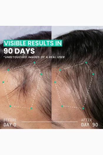 Hair Thickening Dual Action Routine - 90 Day Anti Hair Loss Solution